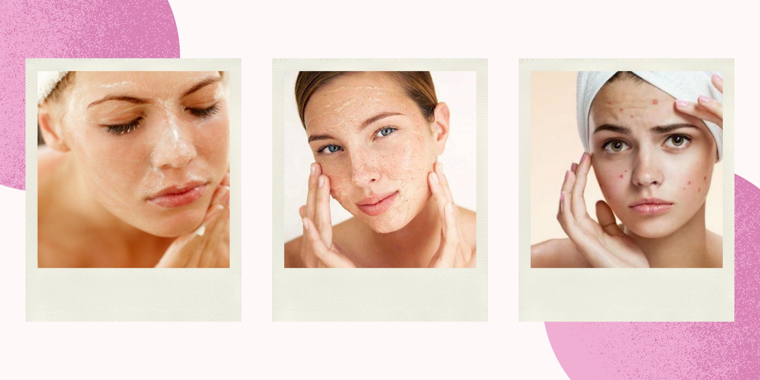 Những Lưu Ý Khi Tẩy Da Chết