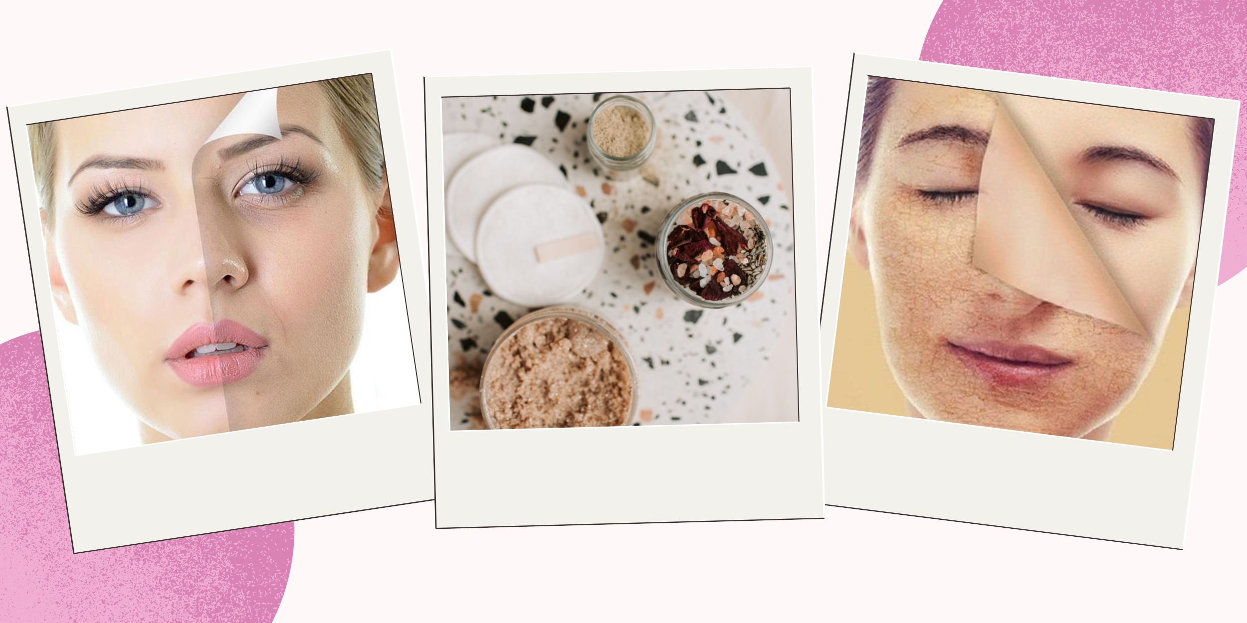 Tẩy Da Chết Là Gì?