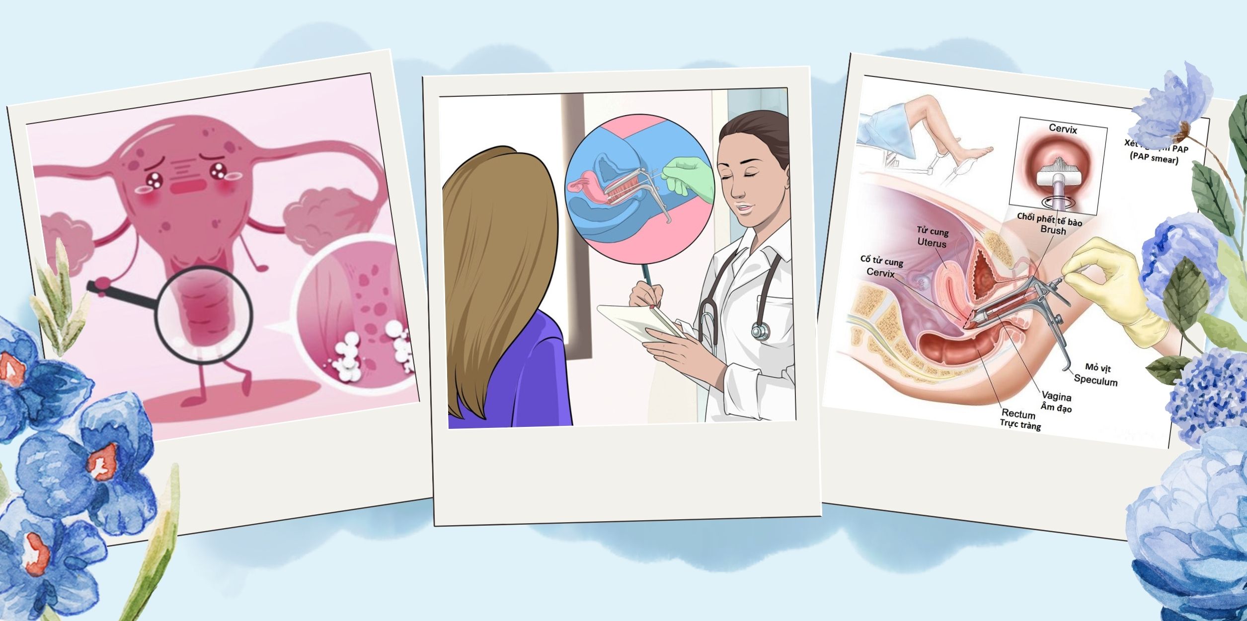 Khám Phụ Khoa Không Chỉ Để Phát Hiện Bệnh