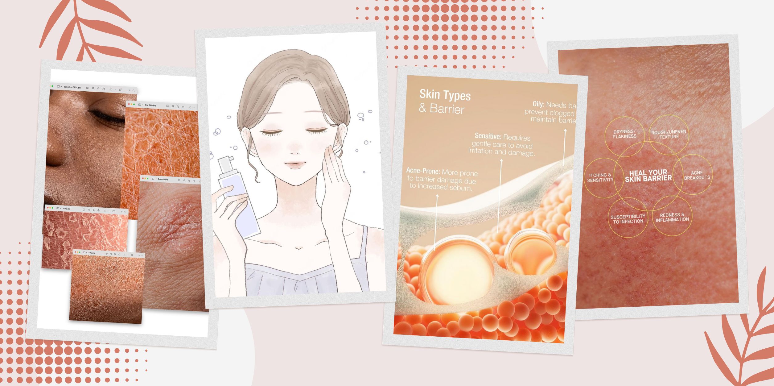 Skin Barrier Là Gì?