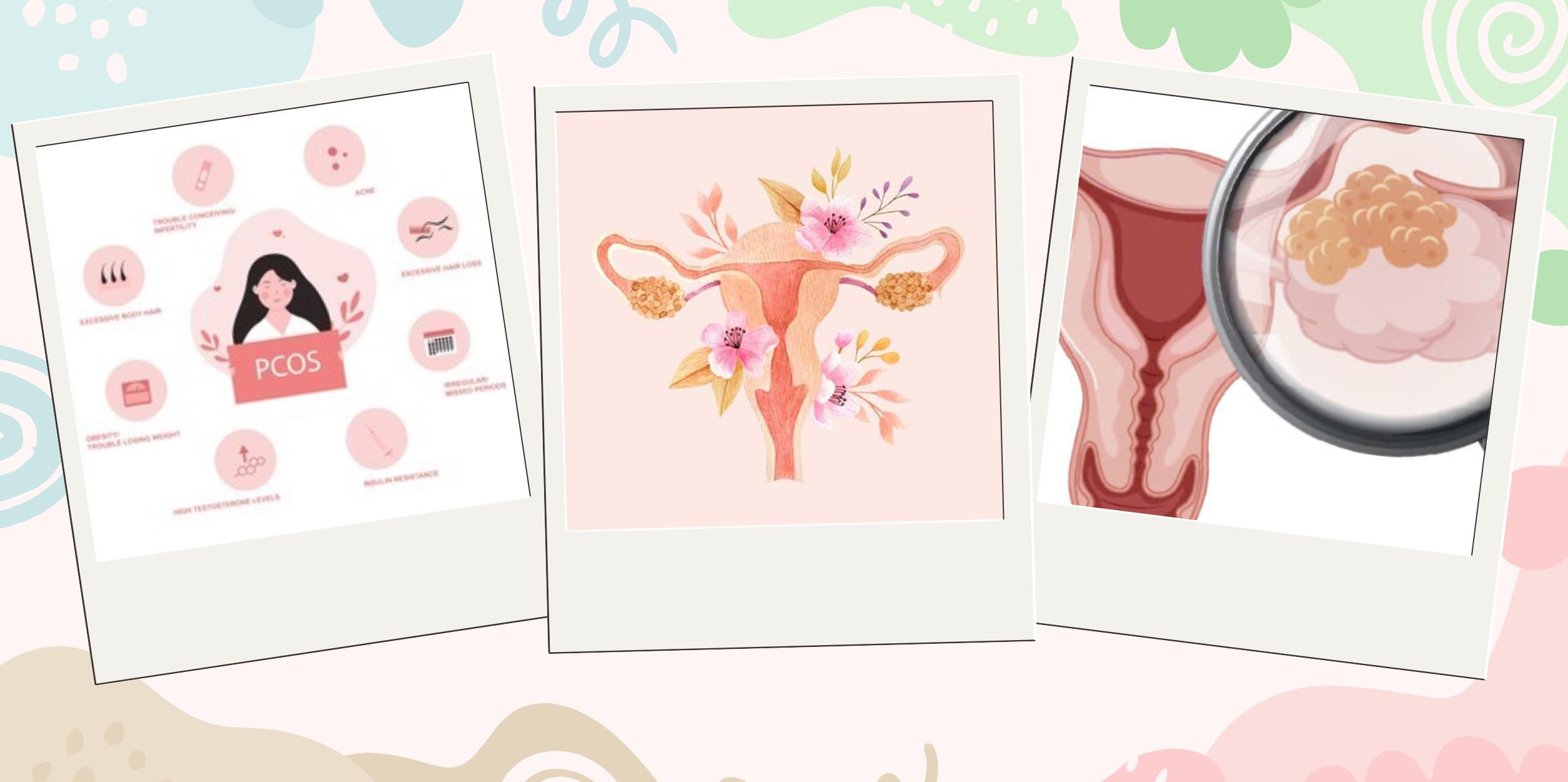 Dấu Hiệu Báo Động Hội Chứng Chị Em Thường Bỏ Qua 
